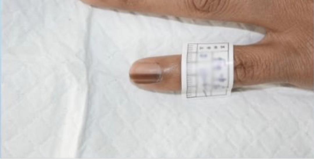 指甲上有黑线的预兆,指甲上有小黑线要注意哪些