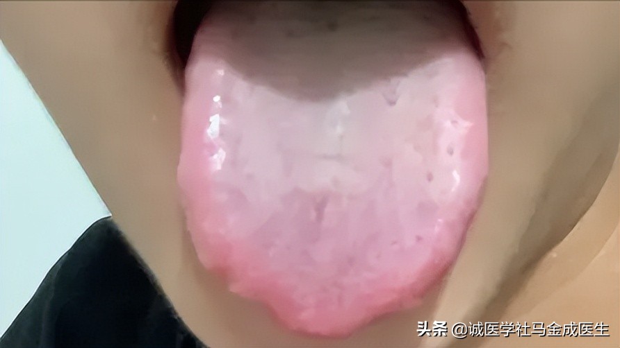 胃胀肚子胀有什么快速消食的方法,胃胀肚子胀最简单的快速解决