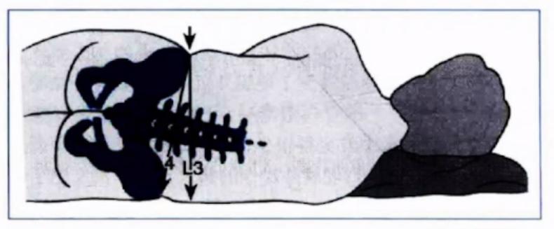 李歆跃：围产期神经系统并发症