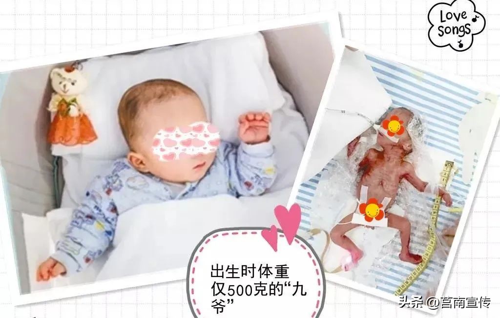 早产儿体重2斤能存活吗,不到两斤的早产儿能存活吗