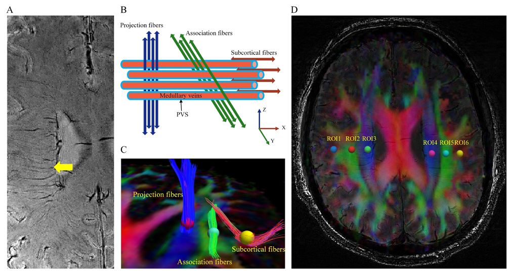 世界帕金森病日第28个主题,世界帕金森病日完整版