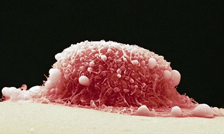 性接触传播疾病的防范教育,通过性传播的疾病有什么危害