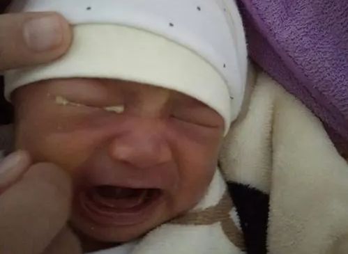 为什么新生儿都是单眼皮,新生儿出生是单眼皮会变双眼皮吗