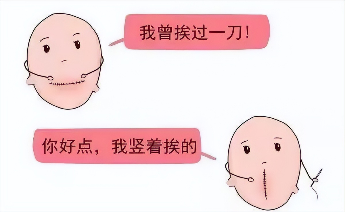 降低剖宫产率,瑞安市人民医院又一例瘢痕子宫成功阴道分娩