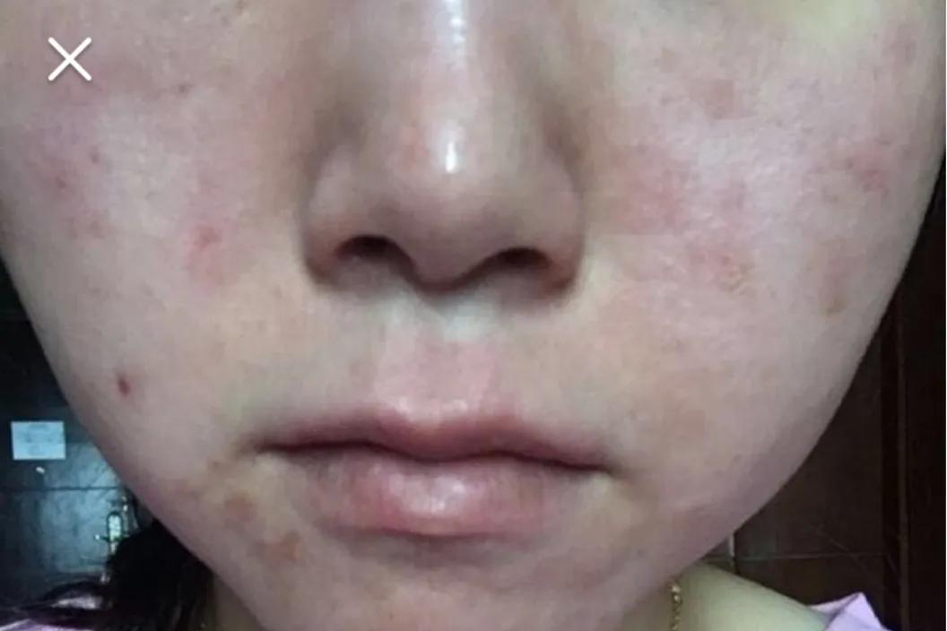 最大的*局骗**“面膜”，它真的有效吗？