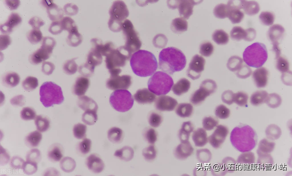 老年人白细胞2.6多无任何症状,老年人白细胞增高怎么降得快点