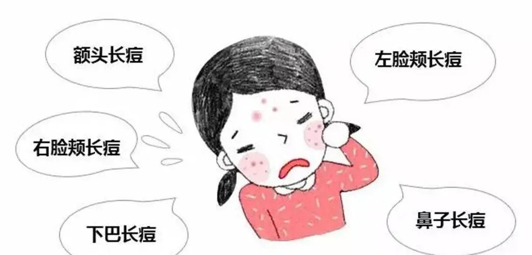 治痘过程中为什么频繁爆痘,战痘最快最有效方法是什么