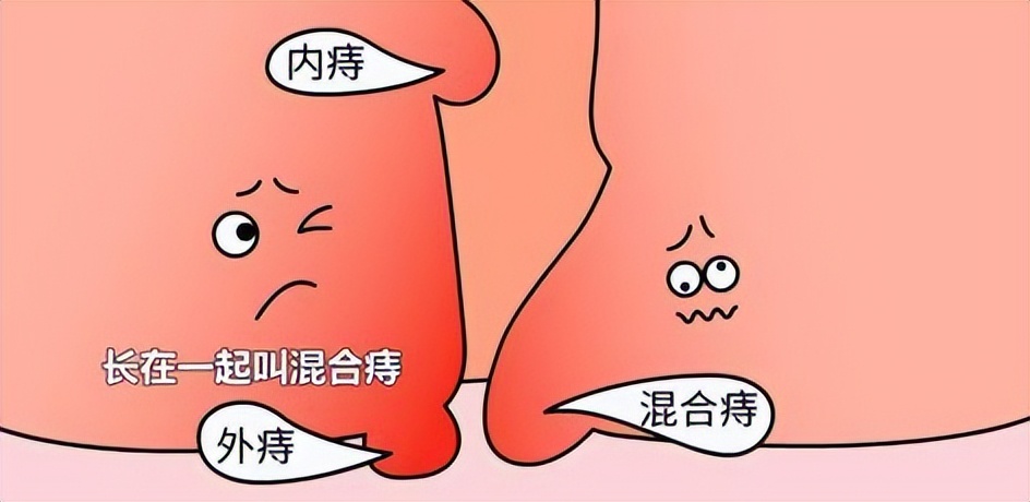 你有洗屁屁的习惯吗,你有洗屁股的习惯吗