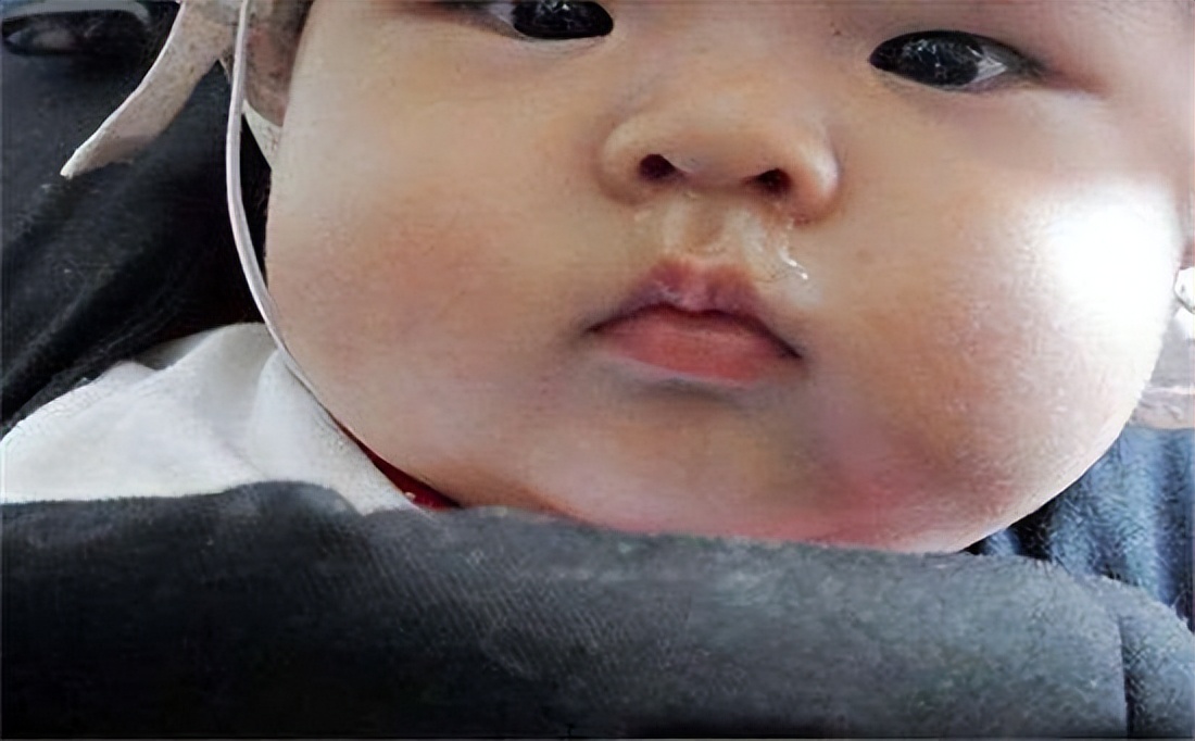 孩子咳嗽吃药马上不咳嗽好不好,孩子咳嗽要立马吃止咳药吗