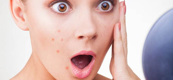 最全祛痘方法针对各种痘痘,有什么办法祛痘不会反反复复