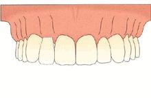鍙ｈ厰涓撳,鍙ｈ厰绉戣鏈変竴棰楀潖鐗欒淇ˉ