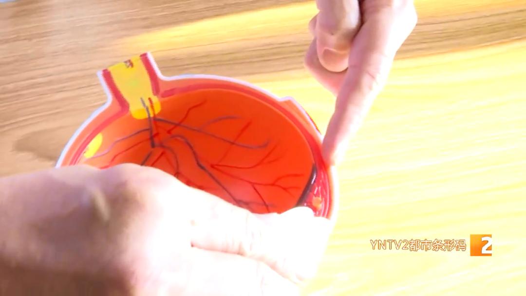 感染新冠后眼睛肿用什么药,感染新冠后眼睛充血怎么办