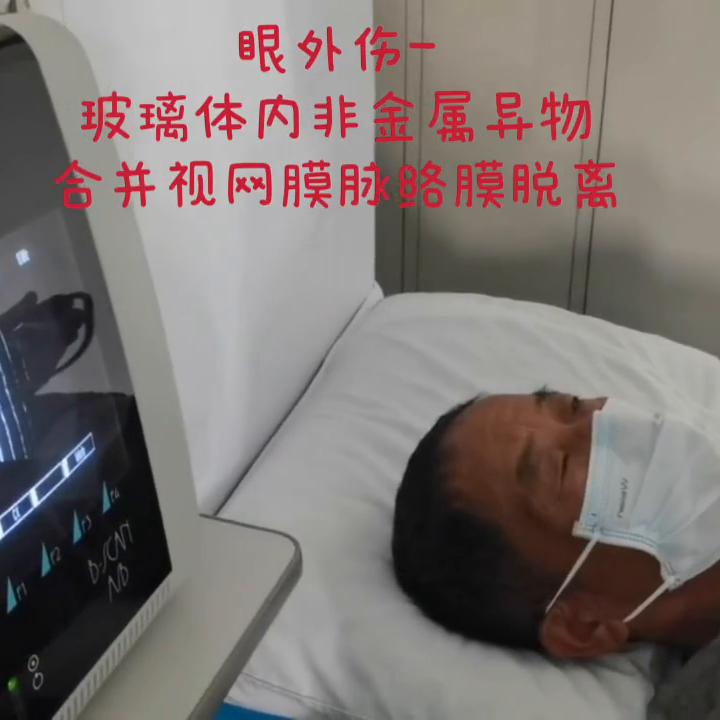 眼底超声检查视网膜裂孔,眼科b超能看出视网膜脱落吗