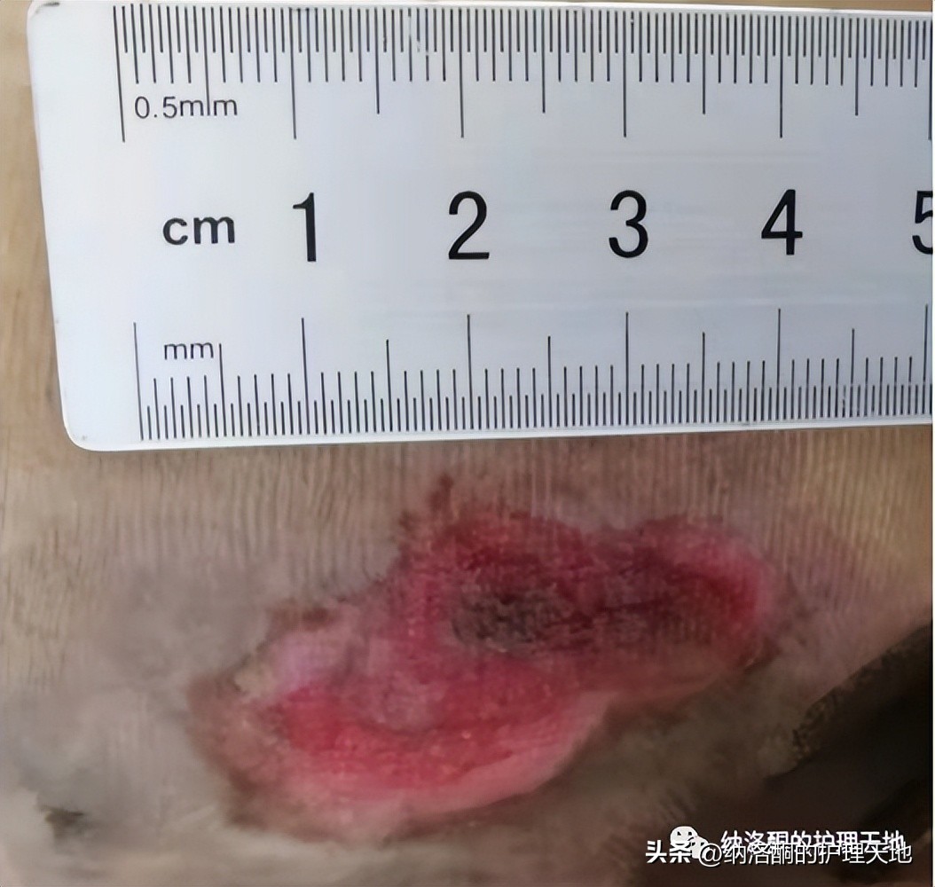 康复新液恢复创面效果怎么样,康复新液可以治疗胃不舒服吗