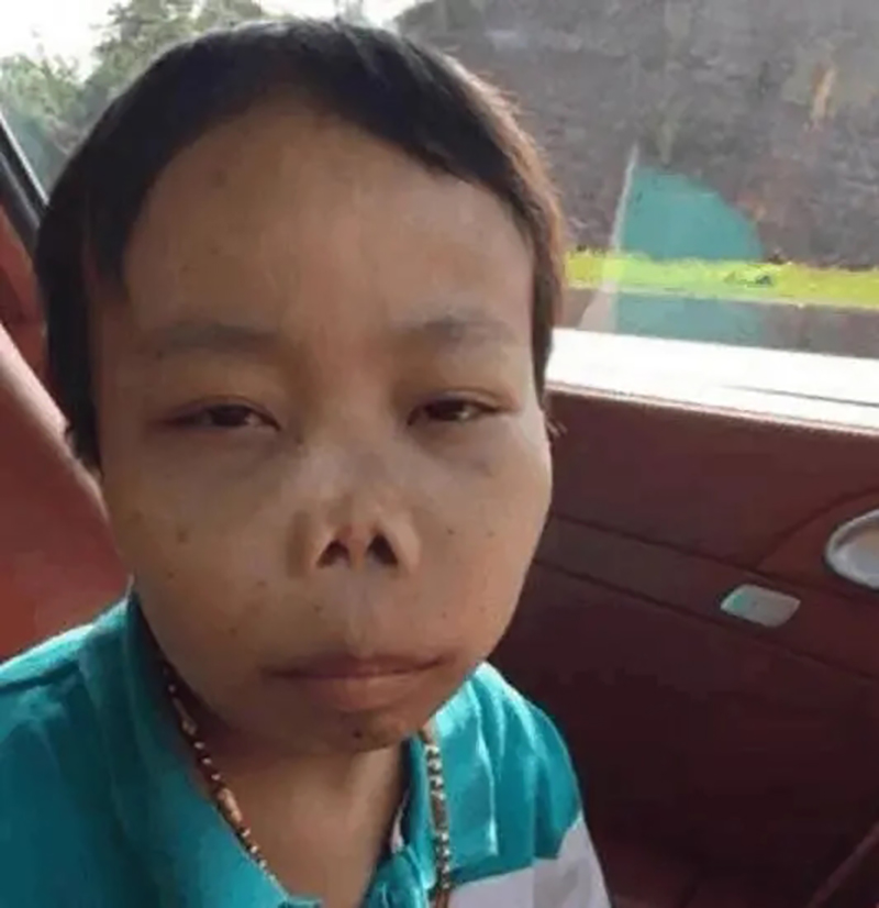 曾经的网红陈山现在的处境,陈山为什么成网红