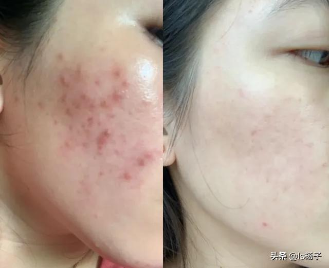 肤色变白最有效的方法,如何让又黄又暗肤色变白