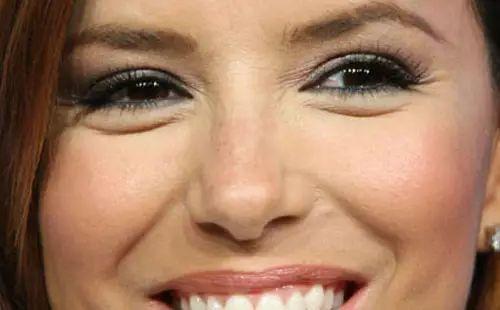 二十几岁鱼尾纹法令纹严重怎么办,十几岁鱼尾纹怎么去除男生