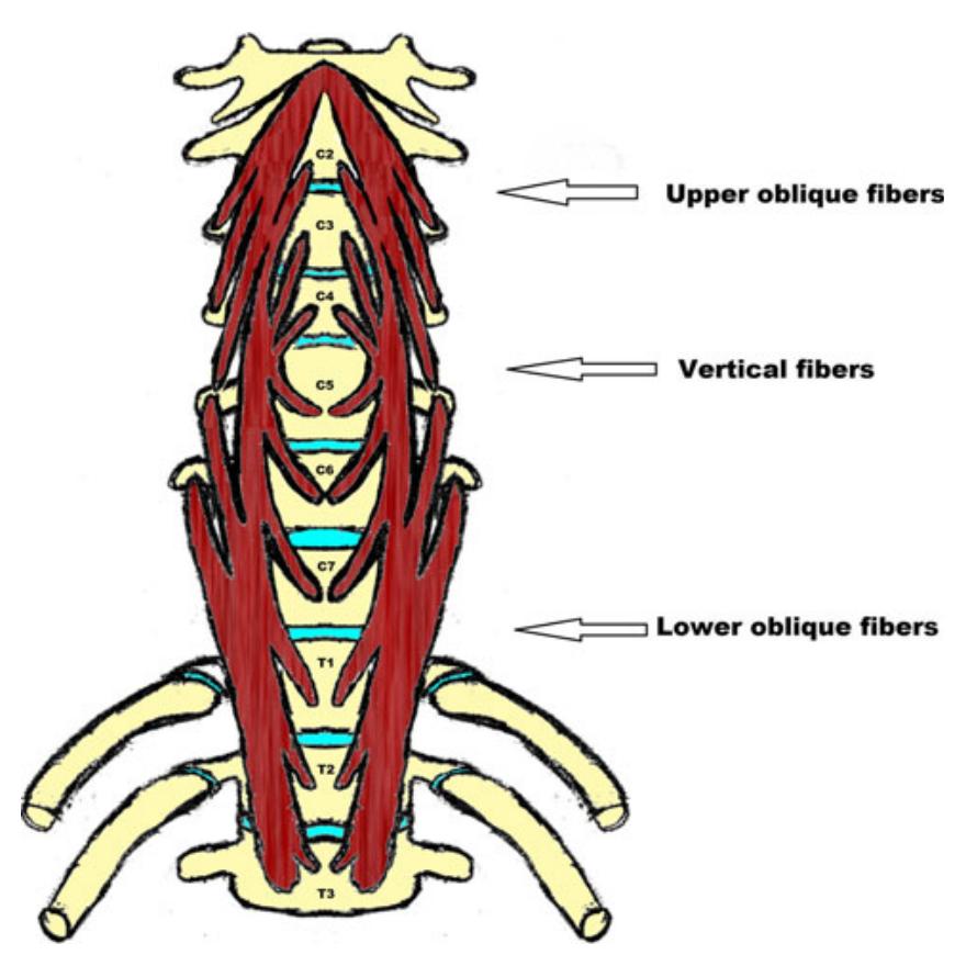 颈长肌腱炎影像表现,三头肌钙化性肌腱炎治疗
