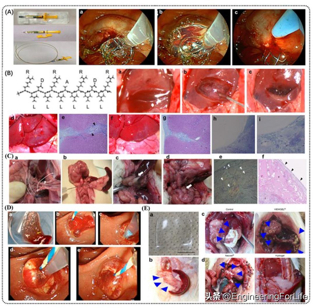 基于dSAP生物材料的纳米止血剂--从实验室到临床的科学之路
