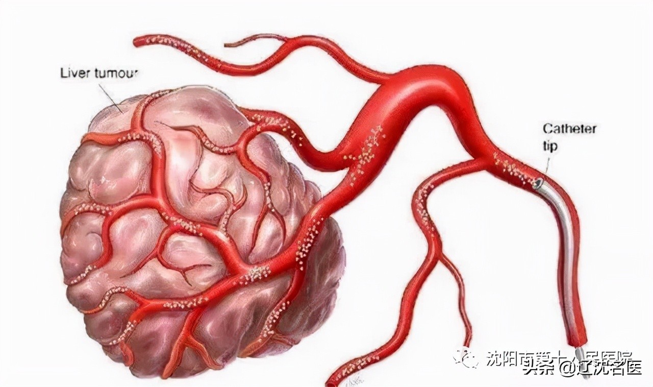 沈阳市第十一人民医院简介,沈阳第十人民医院官网