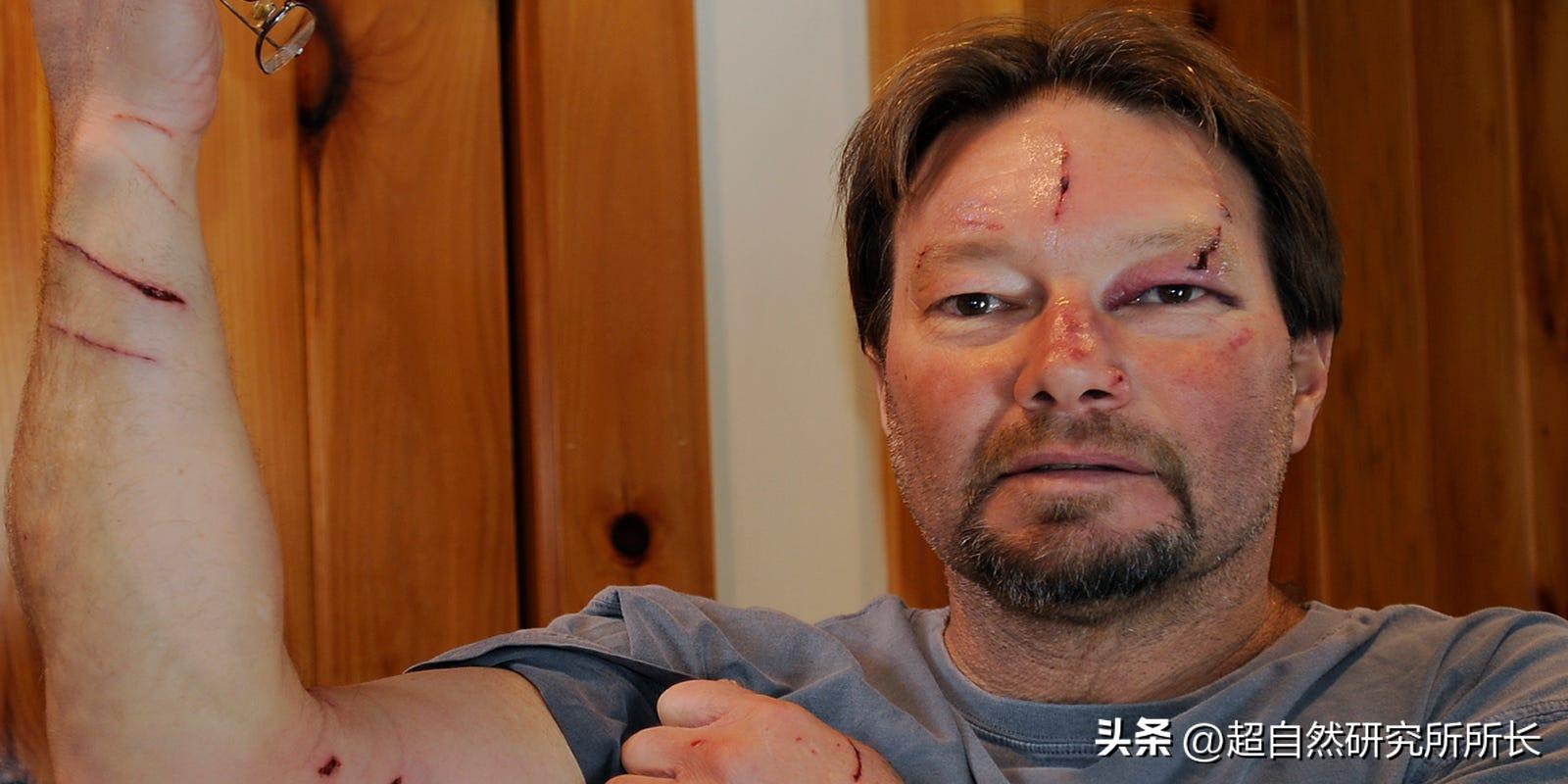 被狗咬了太可怕,被狗咬了才知道疼