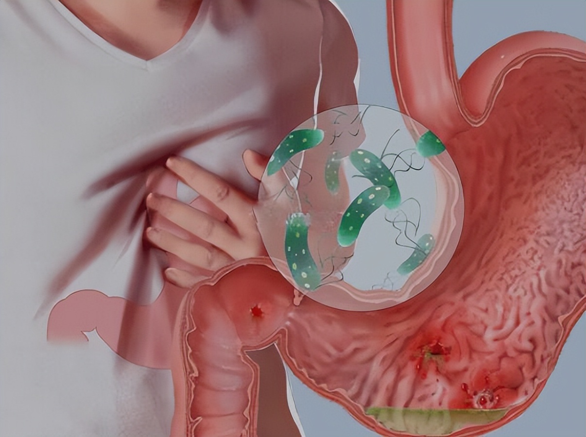 一瓶甲硝唑,几块钱的甲硝唑能有三种作用