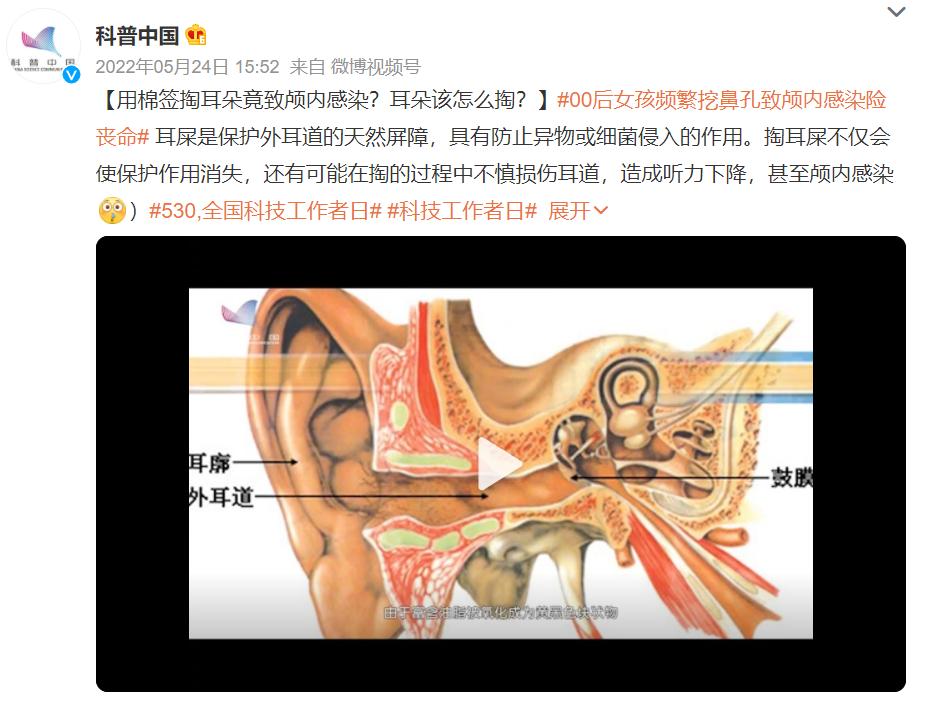 多久给宝宝清理一次耳道,多久给宝宝掏一次耳朵