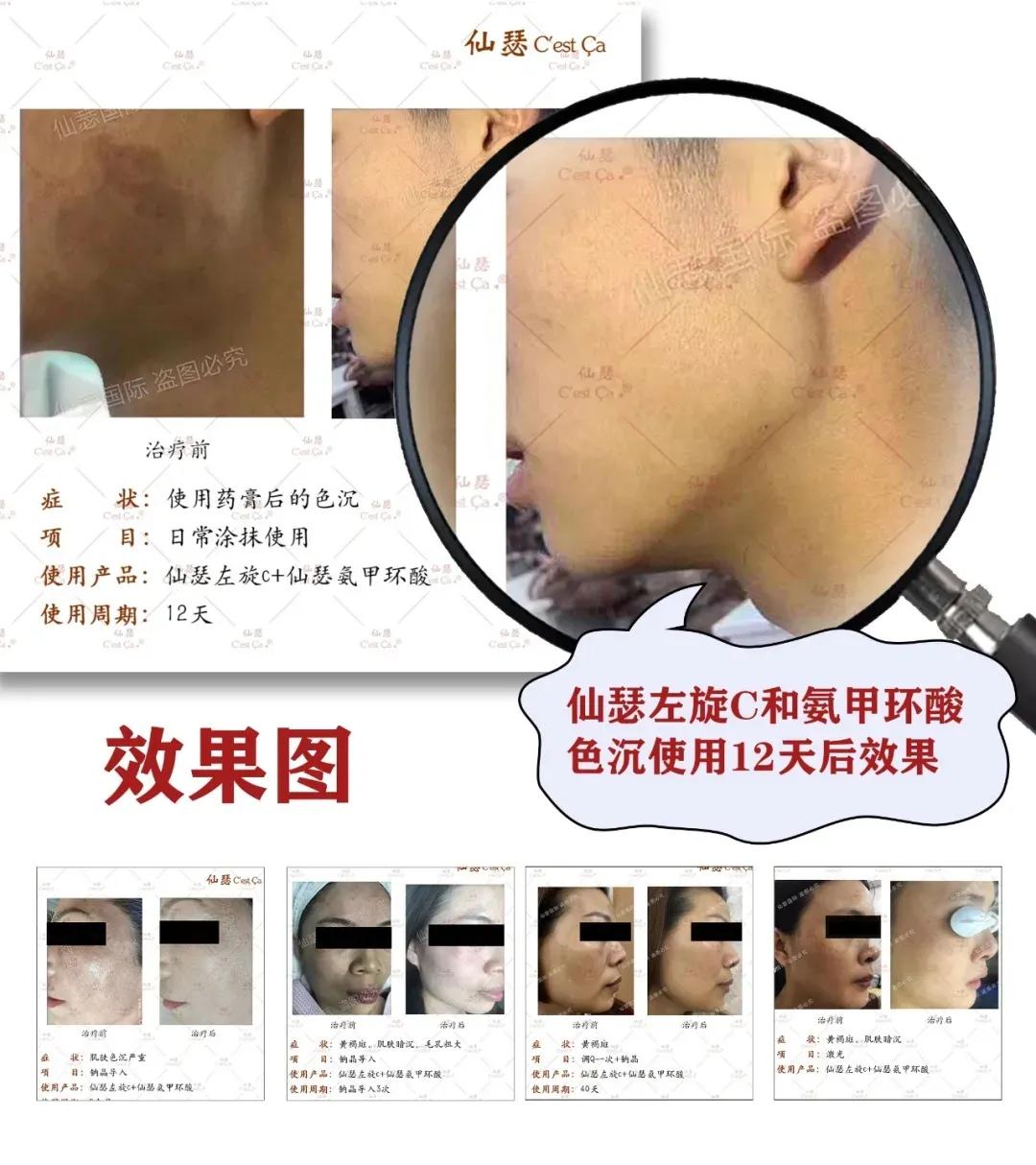 仙瑟左旋维生素c精华液浓度,仙瑟左旋维c精华液