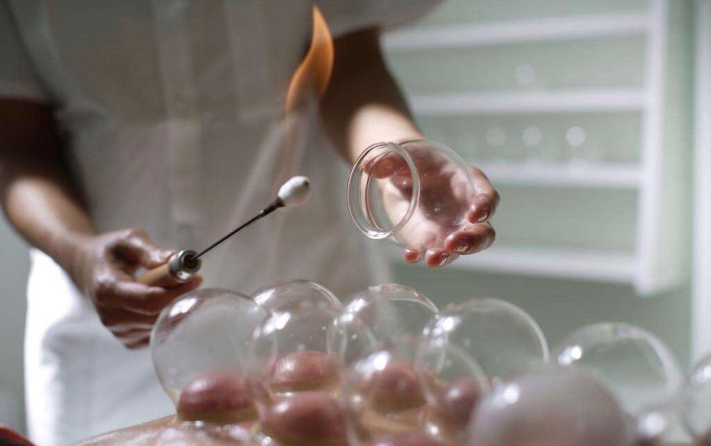 刺络拔罐治什么病,刺络拔罐全过程