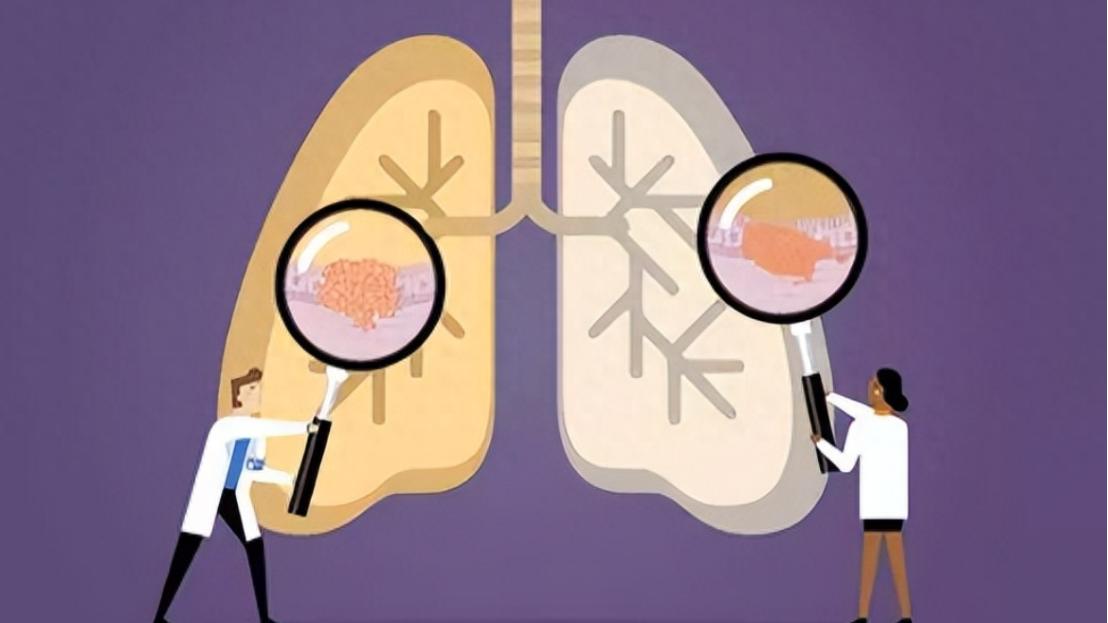 高温治疗是否可以杀死癌细胞,高温杀死癌细胞吗是真的吗