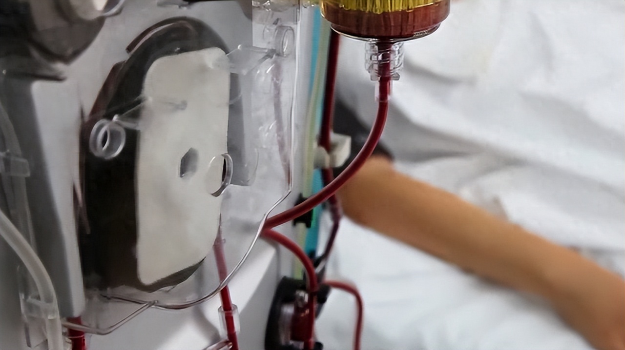 45岁亿万富翁与儿子换血,45岁亿万富豪重回18岁