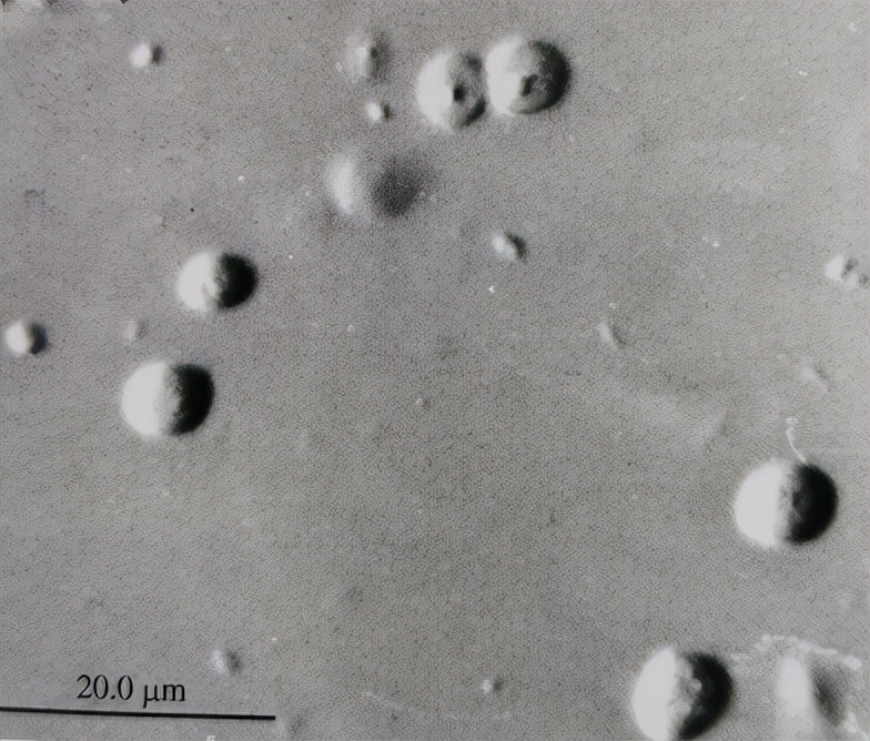 uu感染会自愈么,uu感染是hiv吗