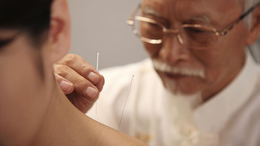 刺络拔罐联合常规针刺治疗神经根型颈椎病如何治疗?疗效如何?