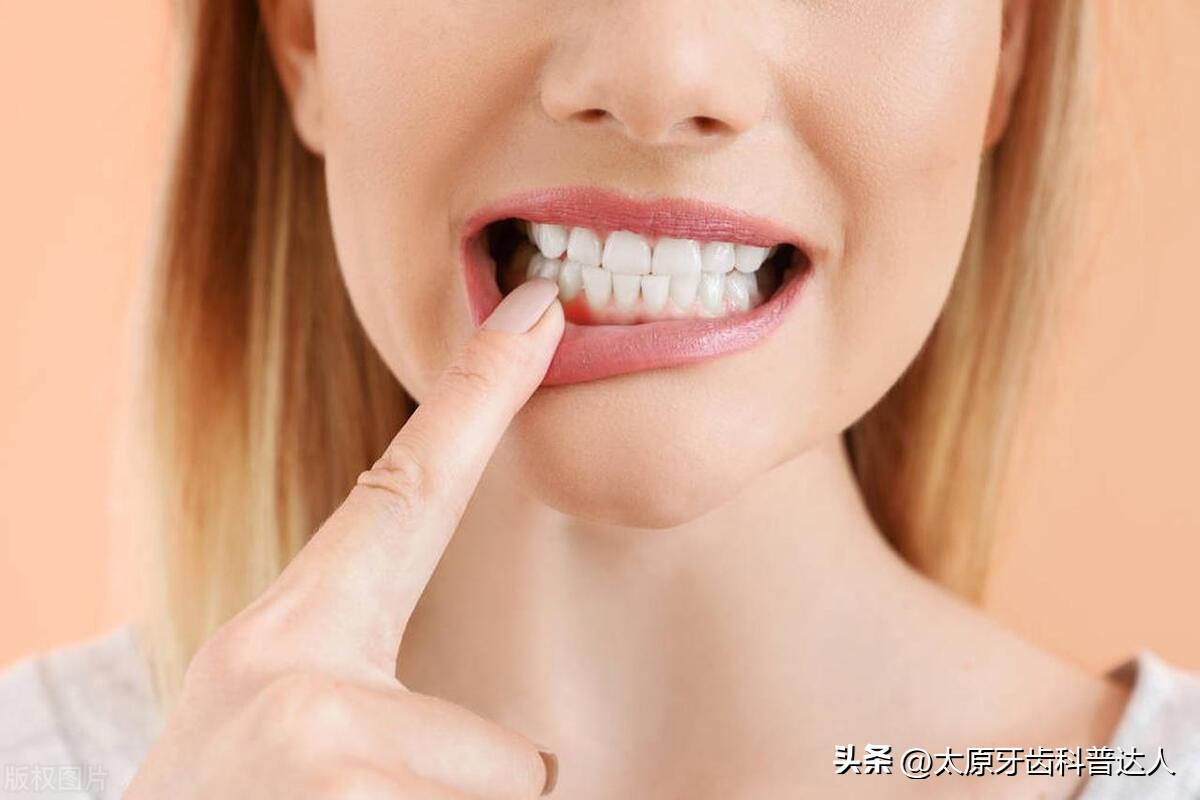 牙龈炎牙周炎相关知识,牙龈炎牙周炎保健知识科普