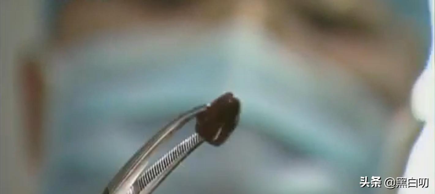 男子心脏不舒服不去医院,心脏不舒服去医院怎样查