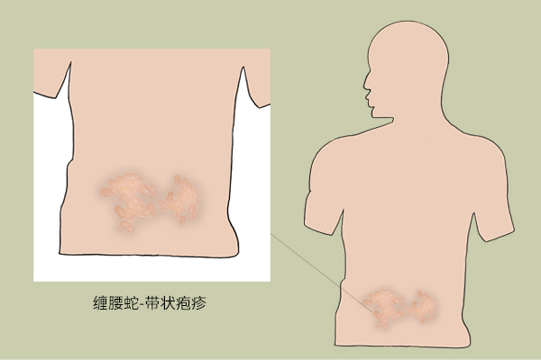 身上小红点变成褐色是什么原因,身上有凸起的小红点是什么原因