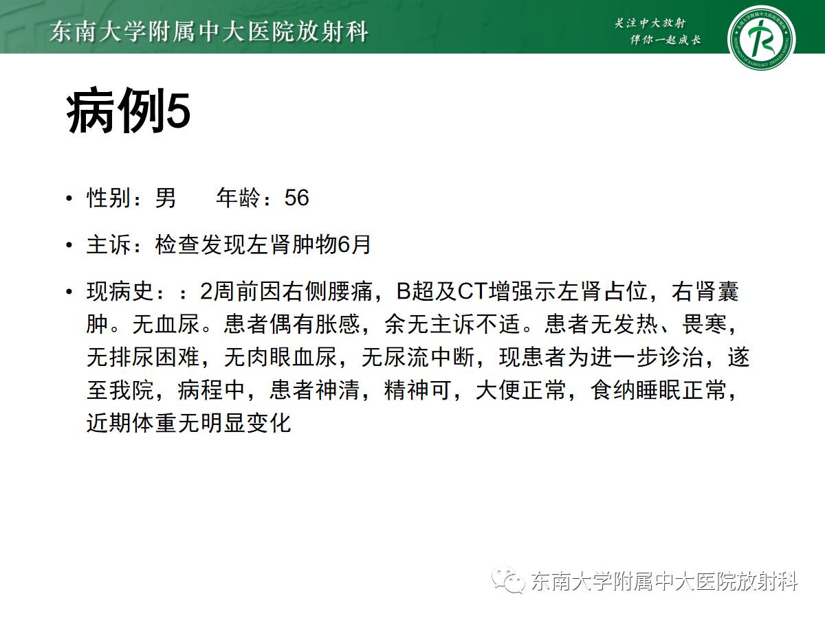 周利群谈肾嫌色细胞癌ct特点,好文分享值得深思