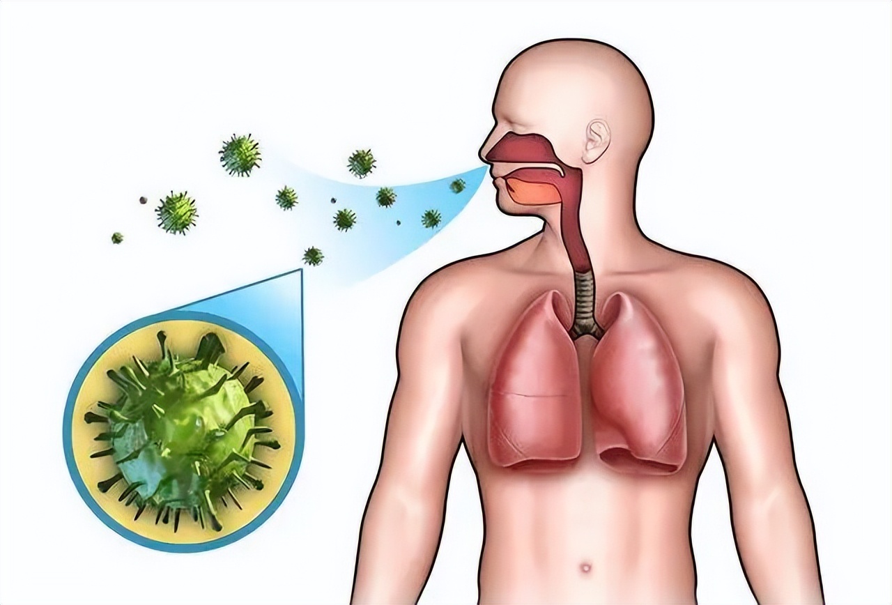 痰的颜色代表肺部健康状况,怎么区分痰是从肺部来的