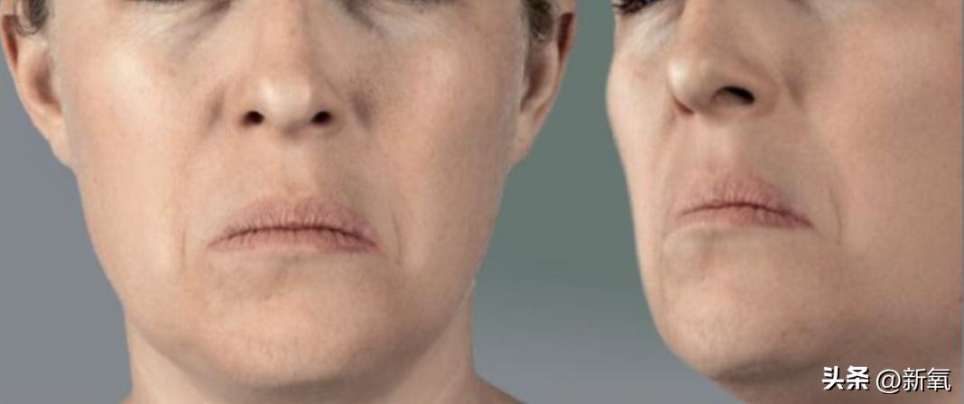 牙齿正畸和骨骼正畸的区别,牙齿正畸和眼轴增长有关系吗