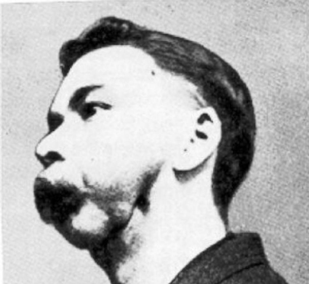 埃本拜尔斯为什么会反反复复发烧,埃本拜尔斯喝了几年