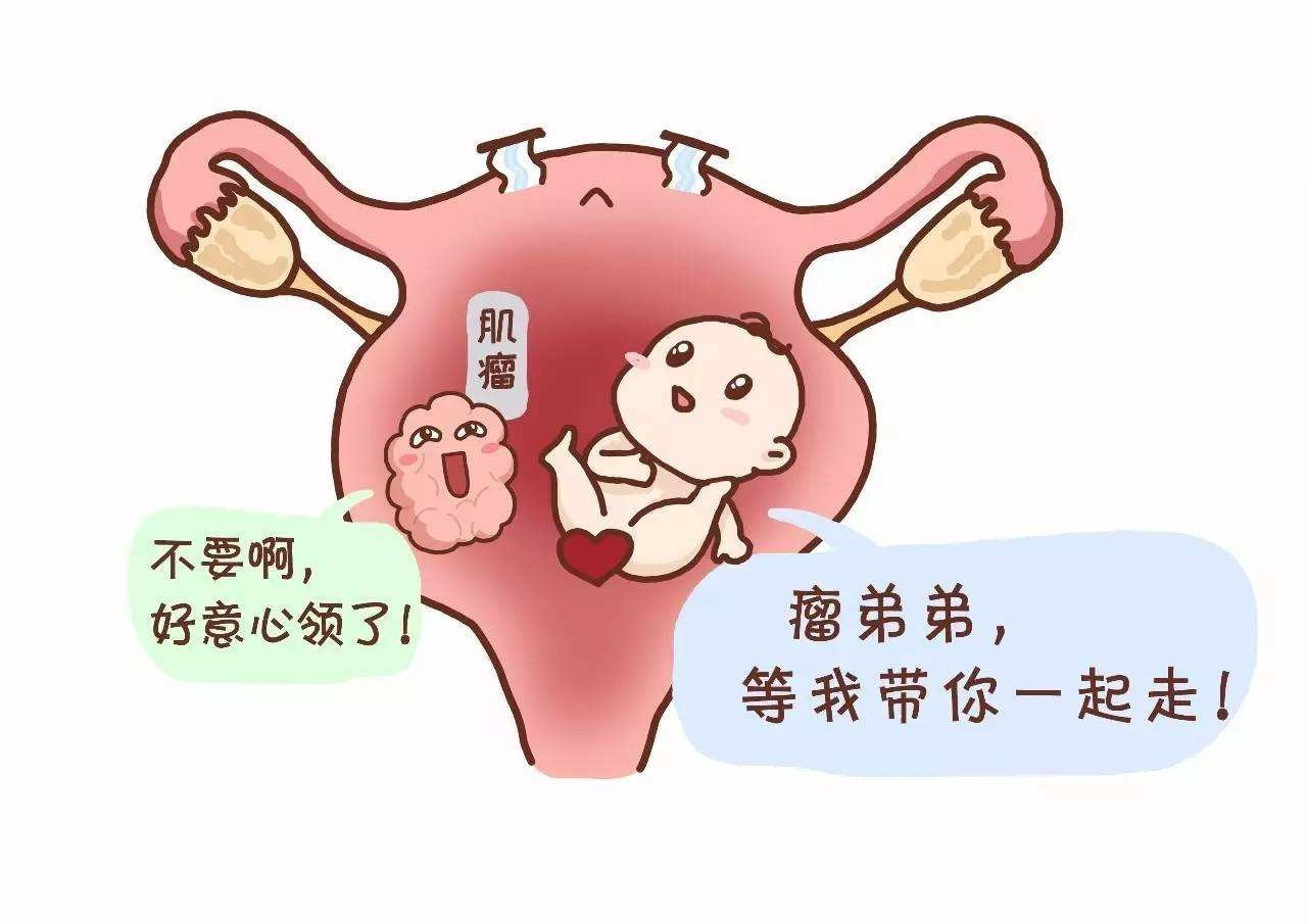 有子宫肌瘤,究竟能不能怀孕?孕期肌瘤会变大吗?