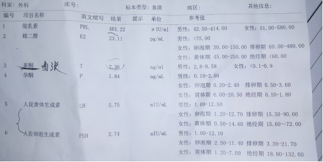 睾酮是由什么控制的,睾酮有什么作用怎样提高睾酮含量