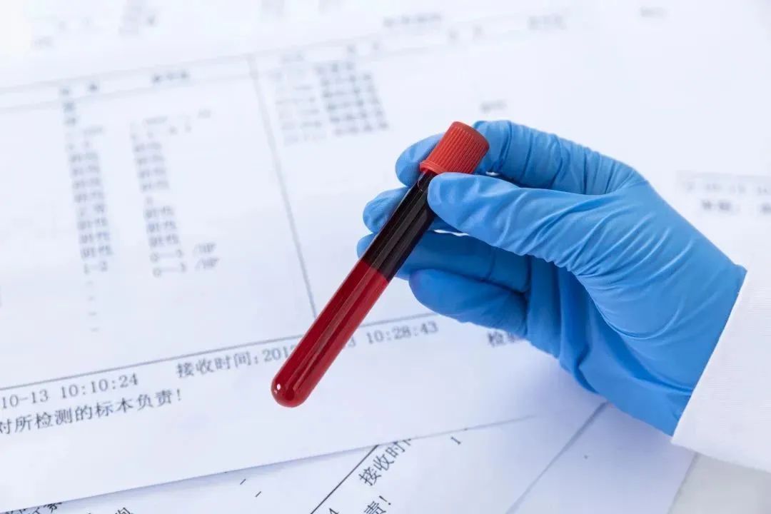 缺铁但是不贫血食补需要多久恢复,80岁老人贫血怎么快速补血食补