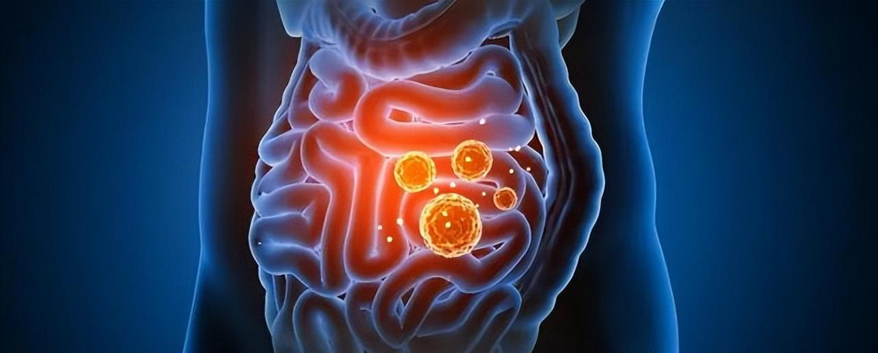 调理脾胃冠心病方子,调理脾胃竟治好了冠心病