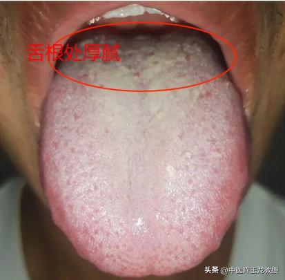 肾虚脚冷腰酸尿频,尿频腰酸是肾阳虚表现吗