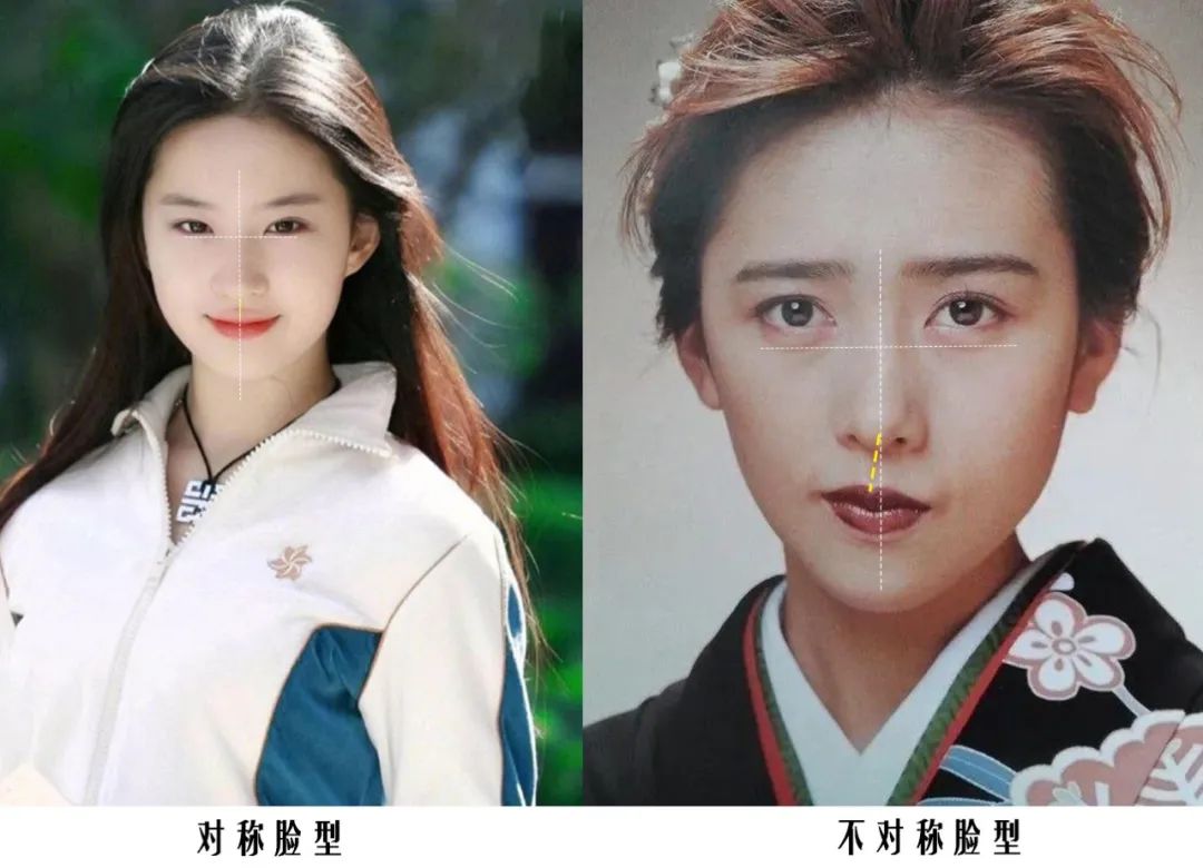 脸型不对称的女孩咋办,脸型不好看怎么整容