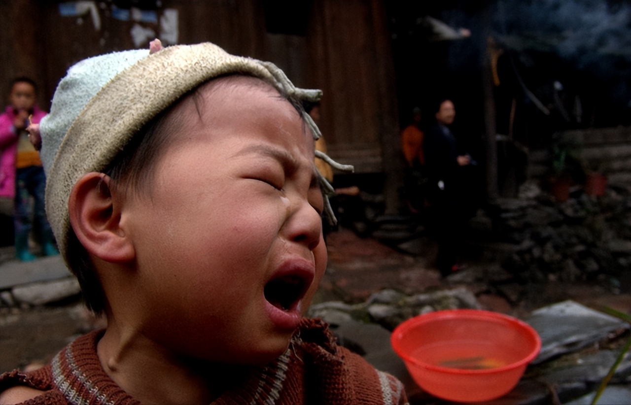 20分钟孩子眼球被融化了,男孩眼睛被融化了