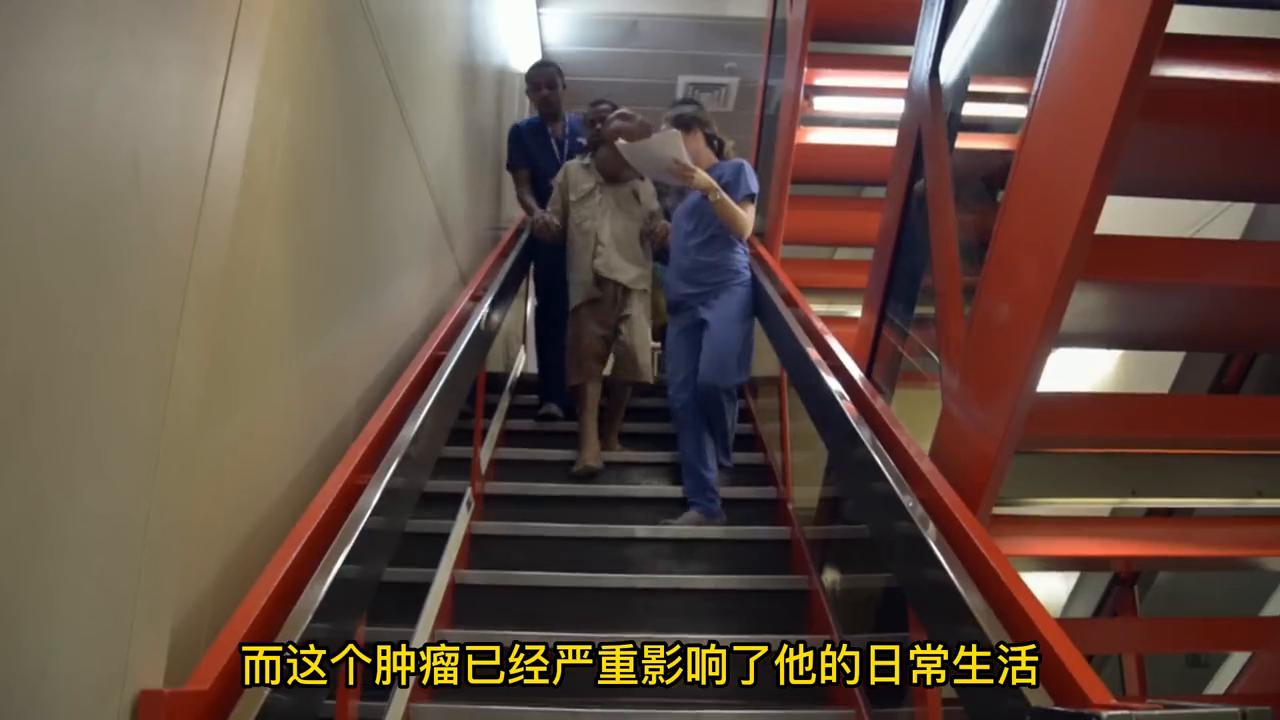 全身长满肿瘤男人后续,男子全身长肿瘤