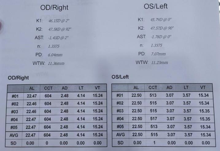 三年级孩子近视能矫正吗,三年级近视了能恢复吗