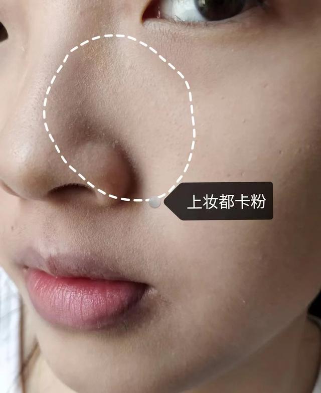 为什么涂完护肤品非常黏腻,护肤品吸收了好还是有粘腻感好